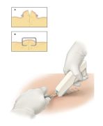 Galena Cilt Stapleri (Cilt Zımbası) 35 Telli